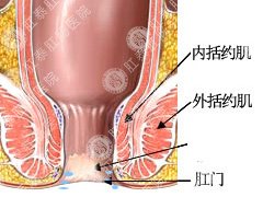肛门瘙痒的不错治疗方法？