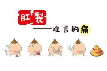 肛裂的危害都有哪些